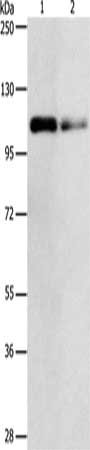 Gel: 8%SDS-PAGE, Lysate: 40 μg, Lane 1-2: Jurkat cells, 293T cells, Primary antibody: KDM1A Antibody(KDM1A Antibody) at dilution 1/500, Secondary antibody: Goat anti rabbit IgG at 1/8000 dilution, Exposure time: 1 minute