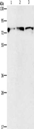 Gel: 8%SDS-PAGE, Lysate: 40 μg, Lane 1-3: Mouse brain tissue, human fetal brain tissue, human brain malignant glioma tissue, Primary antibody: KIF3A Antibody(KIF3A Antibody) at dilution 1/500, Secondary antibody: Goat anti rabbit IgG at 1/8000 dilution, Exposure time: 1 second