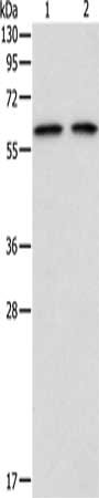 Gel: 8%SDS-PAGE, Lysate: 40 μg, Lane 1-2: 293T cells, hela cells, Primary antibody: ADAM2 Antibody(ADAM2 Antibody) at dilution 1/300, Secondary antibody: Goat anti rabbit IgG at 1/8000 dilution, Exposure time: 15 secondsRabbit anti-Human ADAM2 Polyclonal Antibody