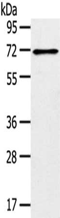 Gel: 8%SDS-PAGE,Lysate: 40 μg,,Primary antibody: TRIM47 Antibody(TRIM47 Antibody) at dilution 1/300 dilution,Secondary antibody: Goat anti rabbit IgG at 1/8000 dilution,Exposure time: 1 minuteRabbit anti-Human TRIM47 Polyclonal Antibody
