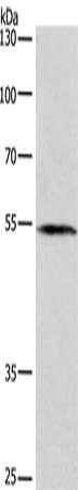 Gel: 8%SDS-PAGE, Lysate: 40 μg, Lane: A172 cells, Primary antibody: BLK Antibody(BLK Antibody) at dilution 1/250, Secondary antibody: Goat anti rabbit IgG at 1/8000 dilution, Exposure time: 2 minutes