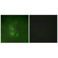 Immunofluorescence analysis of HUVEC cells, using FRK antibody.Rabbit anti-Human FRK Polyclonal Antibody