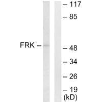 Western blot analysis of extracts from Jurkat cells, using FRK antibody.Rabbit anti-Human FRK Polyclonal Antibody