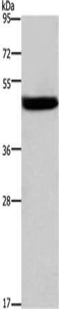 Gel: 8%SDS-PAGE,Lysate: 40 μg,,Primary antibody: CTSE Antibody(CTSE Antibody) at dilution 1/525 dilution,Secondary antibody: Goat anti rabbit IgG at 1/8000 dilution,Exposure time: 1 minuteRabbit anti-Human CTSE Polyclonal Antibody