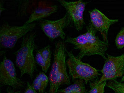 Immunofluorescence staining of methanol-fixed Hela cells using AKT1(phospho-Thr450) Antibody.Rabbit anti-Human AKT1 Polyclonal Antibody