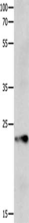 Gel: 12%SDS-PAGE, Lysate: 40 μg, Lane: Human liver cancer tissue, Primary antibody: CLDND1 Antibody(CLDND1 Antibody) at dilution 1/1450, Secondary antibody: Goat anti rabbit IgG at 1/8000 dilution, Exposure time: 40 secondsRabbit anti-Human CLDND1 Polyclonal Antibody