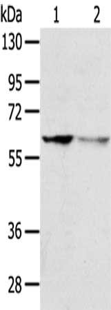 Gel: 8%SDS-PAGE,Lysate: 40 μg,Lane 1-2: Jurkat cells, HepG2 cells,Primary antibody: DHCR24 Antibody(DHCR24 Antibody) at dilution 1/600 dilution,Secondary antibody: Goat anti rabbit IgG at 1/8000 dilution,Exposure time: 2 minutesRabbit anti-Human DHCR24 Polyclonal Antibody
