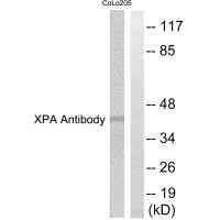 Western blot analysis of extracts from COLO205 cells, using XPA antibody.Rabbit anti-Human XPA Polyclonal Antibody