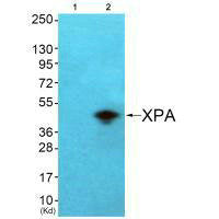 Western blot analysis of extracts from  COS7 cells (Lane 2), using XPA antiobdy. The lane on the left is treated with systhesized peptide.Rabbit anti-Human XPA Polyclonal Antibody