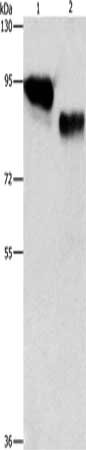 Gel: 10%SDS-PAGE, Lysate: 40 μg, Lane 1-2: Raji cells, huvec cells, Primary antibody: ICAM1 Antibody(ICAM1 Antibody) at dilution 1/950, Secondary antibody: Goat anti rabbit IgG at 1/8000 dilution, Exposure time: 1 secondRabbit anti-Human ICAM1 Polyclonal Antibody