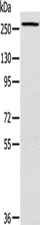 Gel: 6%SDS-PAGE, Lysate: 40 μg, Lane: Huvec cells, Primary antibody: TLN1 Antibody(TLN1 Antibody) at dilution 1/200, Secondary antibody: Goat anti rabbit IgG at 1/8000 dilution, Exposure time: 5 secondsRabbit anti-Human TLN1 Polyclonal Antibody