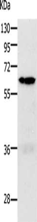 Gel: 10%SDS-PAGE, Lysate: 40 μg, Lane 1-2: 293T cells, K562 cells, Primary antibody: PAK1 Antibody(PAK1 Antibody) at dilution 1/700, Secondary antibody: Goat anti rabbit IgG at 1/8000 dilution, Exposure time: 1 minuteRabbit anti-Human PAK1 Polyclonal Antibody