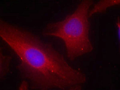Immunofluorescence staining of methanol-fixed Hela cells using p56Dok-2(Ab-299) Antibody.Rabbit anti-Human DOK2 Polyclonal Antibody