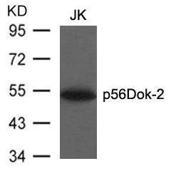 Western blot analysis of extracts from JK cells using p56Dok-2(Ab-299) Antibody.Rabbit anti-Human DOK2 Polyclonal Antibody