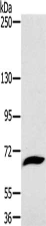 Gel: 6%SDS-PAGE, Lysate: 40 μg, Lane: Mouse liver tissue, Primary antibody: GP1BA Antibody(GP1BA Antibody) at dilution 1/800, Secondary antibody: Goat anti rabbit IgG at 1/8000 dilution, Exposure time: 1 minuteRabbit anti-Human GP1BA Polyclonal Antibody