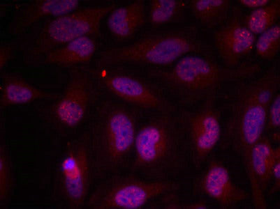 Immunofluorescence staining of methanol-fixed Hela cells using Myc(Phospho-Thr358) Antibody.Rabbit anti-Human MYC Polyclonal Antibody
