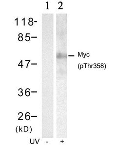 Western blot analysis of extracts from HT29 cells untreated(lane 1) or treated with UV(lane 2) using Myc(Phospho-Thr358) Antibody.Rabbit anti-Human MYC Polyclonal Antibody