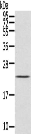 Gel: 12%SDS-PAGE, Lysate: 40 μg, Lane: Human placenta tissue, Primary antibody: IL31 Antibody(IL31 Antibody) at dilution 1/200, Secondary antibody: Goat anti rabbit IgG at 1/8000 dilution, Exposure time: 1 minuteRabbit anti-Human IL31 Polyclonal Antibody