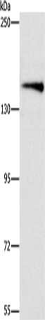 Gel: 6%SDS-PAGE, Lysate: 40 μg, Lane: Mouse brain tissue, Primary antibody: ARHGEF11 Antibody(ARHGEF11 Antibody) at dilution 1/1000, Secondary antibody: Goat anti rabbit IgG at 1/8000 dilution, Exposure time: 1 minuteRabbit anti-Human ARHGEF11 Polyclonal Antibody