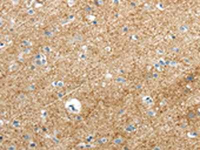The image on the left is immunohistochemistry of paraffin-embedded Human brain tissue using the antibody Antibody) at dilution 1/35, on the right is treated with synthetic peptide. (Original magnification: ×200)Rabbit anti-Human VAMP1 Polyclonal Antibody