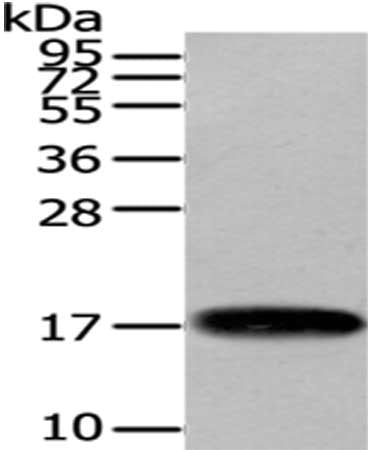 Gel: 12%SDS-PAGE,Lysate: 40 μg,,Primary antibody: VAMP1 Antibody(VAMP1 Antibody) at dilution 1/200 dilution,Secondary antibody: Goat anti rabbit IgG at 1/8000 dilution,Exposure time: 20 secondsRabbit anti-Human VAMP1 Polyclonal Antibody
