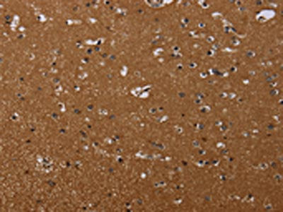 The image on the left is immunohistochemistry of paraffin-embedded Human brain tissue using the antibody Antibody) at dilution 1/20, on the right is treated with synthetic peptide. (Original magnification: ×200)