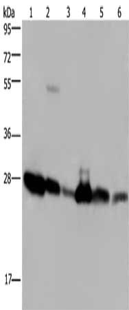 Gel: 10%SDS-PAGE, Lysate: 40 μg, Lane 1-6: A375 cells, K562 cells, mouse liver tissue, Raji cells, Jurkat cells, Hela cells, Primary antibody: MOB1A Antibody(MOB1A Antibody) at dilution 1/200, Secondary antibody: Goat anti rabbit IgG at 1/8000 dilution, Exposure time: 10 secondsRabbit anti-Human MOB1A Polyclonal Antibody