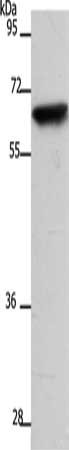 Gel: 10%SDS-PAGE, Lysate: 40 μg, Lane: 231 cells, Primary antibody: SLC22A8 Antibody(SLC22A8 Antibody) at dilution 1/400, Secondary antibody: Goat anti rabbit IgG at 1/8000 dilution, Exposure time: 1 secondRabbit anti-Human SLC22A8 Polyclonal Antibody