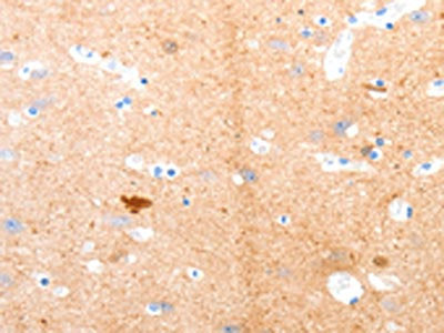 The image on the left is immunohistochemistry of paraffin-embedded Human brain tissue using the antibody  Antibody) at dilution 1/55, on the right is treated with synthetic peptide. (Original magnification: ×200)Rabbit anti-Human GPR3 Polyclonal Antibody
