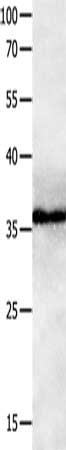 Gel: 10%SDS-PAGE, Lysate: 40 μg, Lane: Human brain malignant glioma tissue, Primary antibody: GPR3 Antibody(GPR3  Antibody) at dilution 1/1100, Secondary antibody: Goat anti rabbit IgG at 1/8000 dilution, Exposure time: 2 minutesRabbit anti-Human GPR3 Polyclonal Antibody