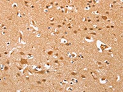 The image on the left is immunohistochemistry of paraffin-embedded Human brain  tissue using AHSG Antibody(AHSG Antibody) at dilution 1/60, on the right is treated with fusion protein. (Original magnification: ×200)Rabbit anti-Human AHSG Polyclonal Antibody