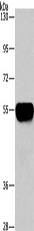 Gel: 10%SDS-PAGE, Lysate: 2 μg, Lane: Human plasma tissue, Primary antibody: AHSG Antibody(AHSG Antibody) at dilution 1/1450, Secondary antibody: Goat anti rabbit IgG at 1/8000 dilution, Exposure time: 10 secondsRabbit anti-Human AHSG Polyclonal Antibody