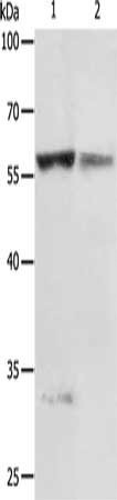 Gel: 10%SDS-PAGE, Lysate: 50 μg, Lane 1-2: Jurkat cells, human fetal liver tissue, Primary antibody: PRCP Antibody(PRCP Antibody) at dilution 1/200, Secondary antibody: Goat anti rabbit IgG at 1/8000 dilution, Exposure time: 5 minutesRabbit anti-Human PRCP Polyclonal Antibody