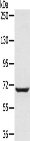 Gel: 6%SDS-PAGE, Lysate: 50 μg, Lane: Raji cells, Primary antibody: PLS3 Antibody(PLS3 Antibody) at dilution 1/200, Secondary antibody: Goat anti rabbit IgG at 1/8000 dilution, Exposure time: 40 secondsRabbit anti-Human PLS3 Polyclonal Antibody