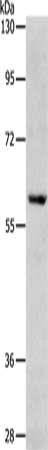 Gel: 8%SDS-PAGE, Lysate: 40 μg, Lane: Jurkat cells, Primary antibody: RPS6KB1 Antibody(RPS6KB1 Antibody) at dilution 1/200, Secondary antibody: Goat anti rabbit IgG at 1/8000 dilution, Exposure time: 1 minuteRabbit anti-Human RPS6KB1 Polyclonal Antibody