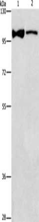 Gel: 6%SDS-PAGE, Lysate: 40 μg, Lane 1-2: Lovo cells, human fetal brain tissue, Primary antibody: ADCY3 Antibody(ADCY3 Antibody) at dilution 1/312.5, Secondary antibody: Goat anti rabbit IgG at 1/8000 dilution, Exposure time: 5 minutesRabbit anti-Human ADCY3 Polyclonal Antibody