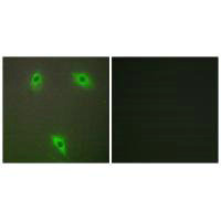 Immunofluorescence analysis of A549 cells, using KLHL3 antibody.Rabbit anti-Human KLHL3 Polyclonal Antibody