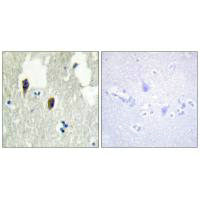 Immunohistochemistry analysis of paraffin-embedded human brain tissue, using KLHL3 antibody.Rabbit anti-Human KLHL3 Polyclonal Antibody
