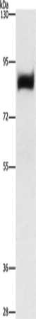 Gel: 6%SDS-PAGE, Lysate: 40 μg, Lane: Human prostate tissue, Primary antibody: LTF Antibody(LTF Antibody) at dilution 1/296, Secondary antibody: Goat anti rabbit IgG at 1/8000 dilution, Exposure time: 5 seconds