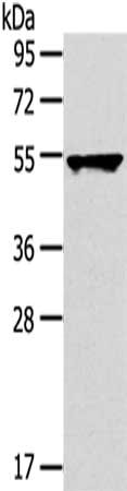Gel: 8%SDS-PAGE,Lysate: 40 μg,,Primary antibody: TRIM10 Antibody(TRIM10 Antibody) at dilution 1/800 dilution,Secondary antibody: Goat anti rabbit IgG at 1/8000 dilution,Exposure time: 30 secondsRabbit anti-Human TRIM10 Polyclonal Antibody