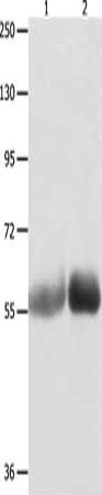 Gel: 8%SDS-PAGE, Lysate: 40 μg, Lane 1-2: Human liver cancer tissue, Human stomach cancer tissue, Primary antibody: MUTYH Antibody(MUTYH Antibody) at dilution 1/1000, Secondary antibody: Goat anti rabbit IgG at 1/8000 dilution, Exposure time: 1 minuteRabbit anti-Human MUTYH Polyclonal Antibody
