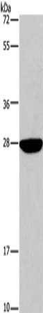 Gel: 15%SDS-PAGE, Lysate: 40 μg, Lane: Mouse liver tissue, Primary antibody: DUSP19 Antibody(DUSP19 Antibody) at dilution 1/600, Secondary antibody: Goat anti rabbit IgG at 1/8000 dilution, Exposure time: 30 secondsRabbit anti-Human DUSP19 Polyclonal Antibody