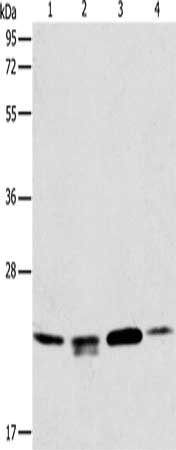 Gel: 12%SDS-PAGE, Lysate: 40 μg, Lane 1-4: 293T cells, hela cells, PC3 cells, human liver cancer tissue, Primary antibody: PRDX2 Antibody(PRDX2 Antibody) at dilution 1/750, Secondary antibody: Goat anti rabbit IgG at 1/8000 dilution, Exposure time: 10 secondsRabbit anti-Human PRDX2 Polyclonal Antibody