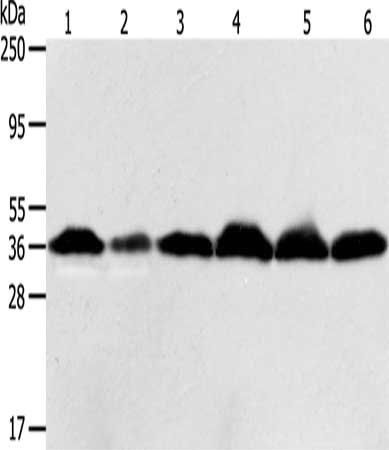 Gel: 12%SDS-PAGE, Lysate: 40 μg, Lane 1-6: Hela cells, human liver cancer tissue, Raji cells, Jurkat cells, 293T cells, PC3 cells, Primary antibody: APEX1 Antibody(APEX1 Antibody) at dilution 1/450, Secondary antibody: Goat anti rabbit IgG at 1/8000 dilution, Exposure time: 1 minuteRabbit anti-Human APEX1 Polyclonal Antibody