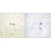 Immunohistochemistry analysis of paraffin-embedded human brain tissue using FAS ligand antibody.Rabbit anti-Human FASLG Polyclonal Antibody