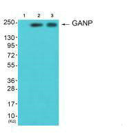 Western blot analysis of extracts from HepG2 cells (Lane 2) and A549 cells (Lane 3), using GANP antiobdy. The lane on the left is treated with synthesized peptide.