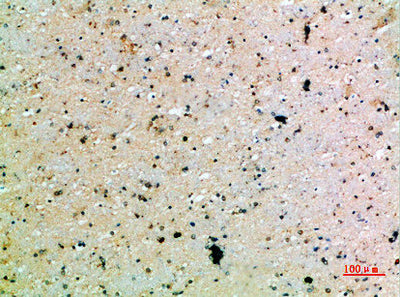 Immunohistochemical analysis of paraffin-embedded human-brain, antibody was diluted at 1:200Rabbit anti-Human PDGFC Polyclonal Antibody