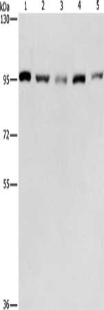 Gel: 6%SDS-PAGE, Lysate: 40 μg, Lane 1-5: HepG2 cells, K562 cells, Jurkat cells, 231 cells, hela cells, Primary antibody: MCM5 Antibody(MCM5 Antibody) at dilution 1/475, Secondary antibody: Goat anti rabbit IgG at 1/8000 dilution, Exposure time: 30 seconds