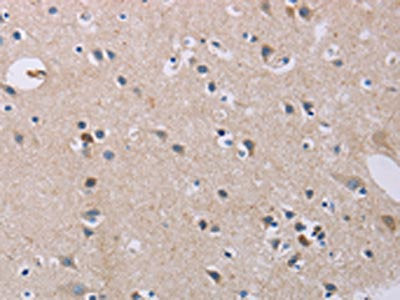 The image on the left is immunohistochemistry of paraffin-embedded Human brain  tissue using CD33 Antibody(CD33 Antibody) at dilution 1/40, on the right is treated with fusion protein. (Original magnification: ×200)Rabbit anti-Human CD33 Polyclonal Antibody
