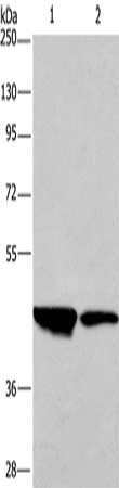 Gel: 10%SDS-PAGE, Lysate: 40 μg, Lane 1-2: Human testis tissue, Human placenta tissue, Primary antibody: CD33 Antibody(CD33 Antibody) at dilution 1/450, Secondary antibody: Goat anti rabbit IgG at 1/8000 dilution, Exposure time: 30 secondsRabbit anti-Human CD33 Polyclonal Antibody